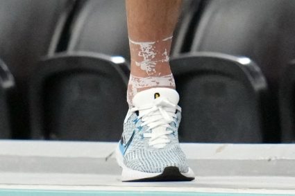 Harry Kane để lộ mắt cá chân bất thường